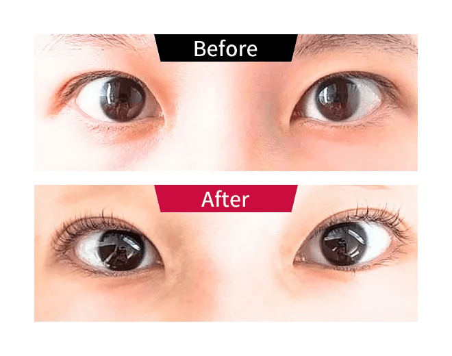 ビフォーアフター01