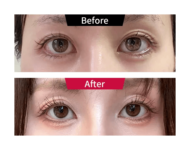 ビフォーアフター01