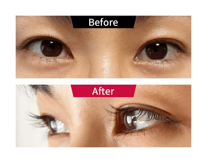 ビフォーアフター01