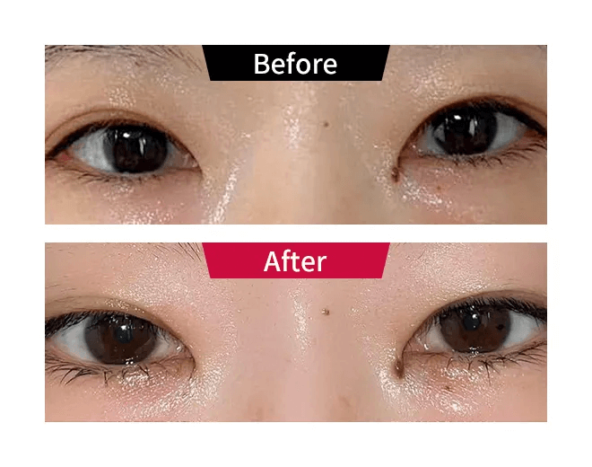 ビフォーアフター01