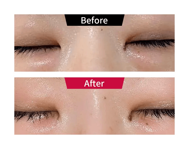 ビフォーアフター01